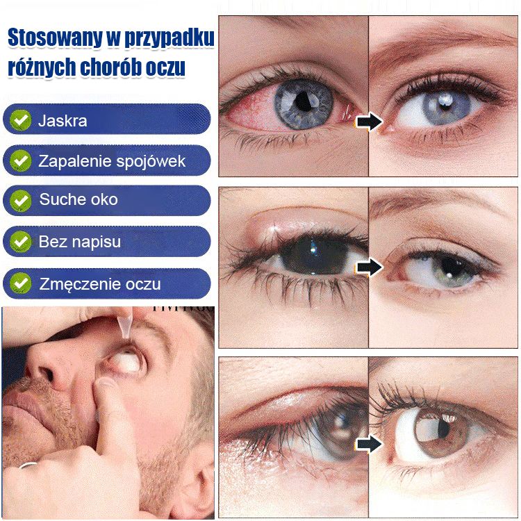 Krople do pielęgnacji oczu
