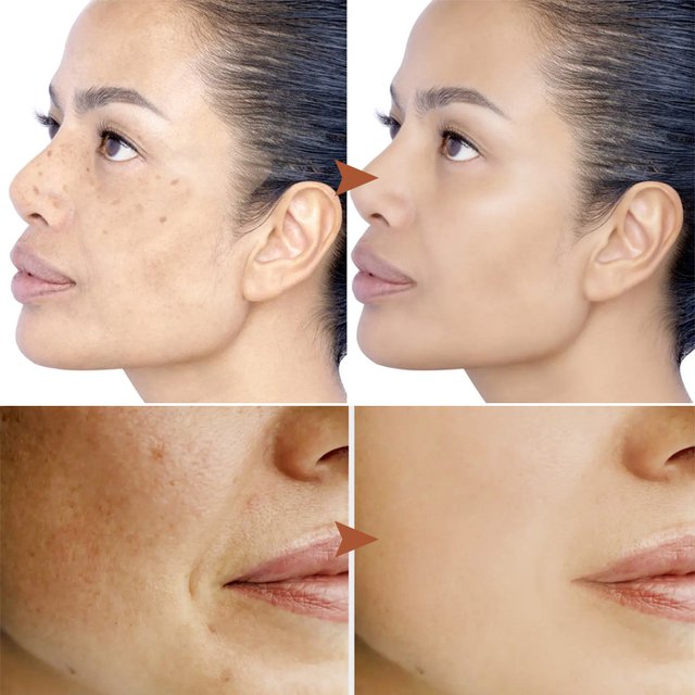 【Głęboko oczyszczająca, niepodrażniająca】Maseczka peel-off wybielająca odpowiednia dla skóry wrażliw