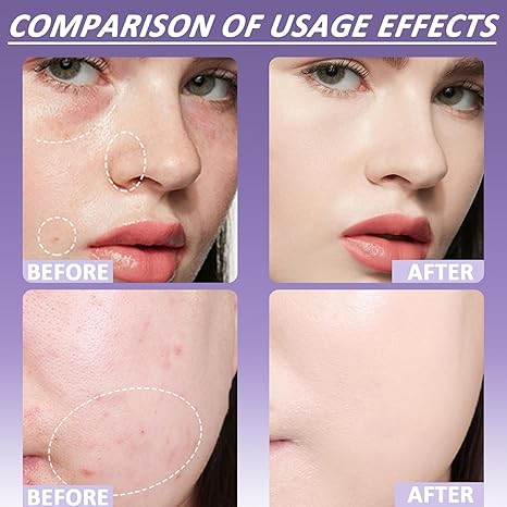 🔥 Kup jeden, a drugi dostaniesz gratis! 🎁 Miękki, matowy korektor w kremie