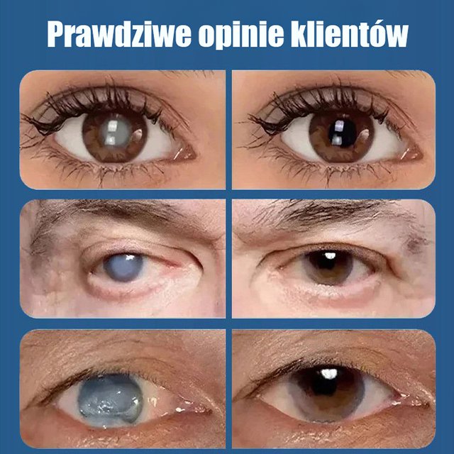 Krople do pielęgnacji oczu