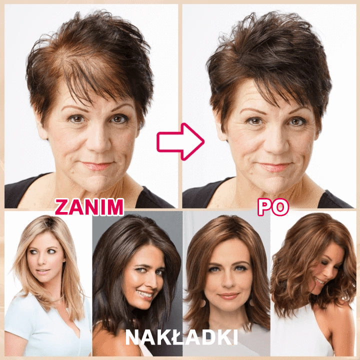 ✨Prirodzené priedušné vlasy pre ženy s riedkymi vlasmi💁‍♀️-GR